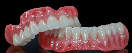 Digital Wax Up
